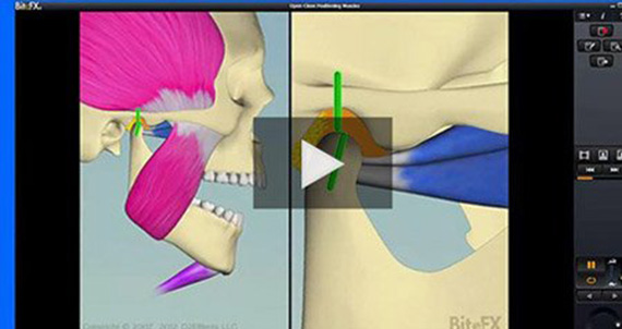 BiteFX Consultation Animation