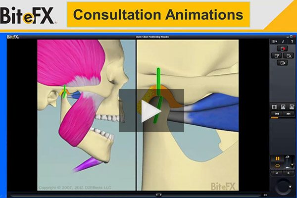 BiteFX™ Knoxville TN - Learn About Your Next Dental Procedure