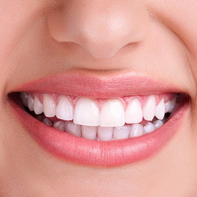 Sinsational Smile Teeth Whitening, TN
