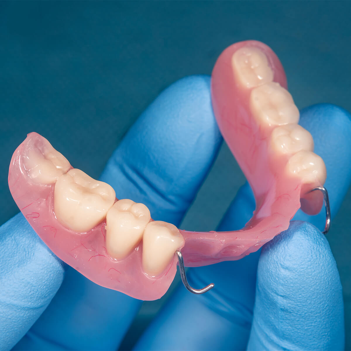 Partial Dentures for Front Teeth in Knoxville TN Area