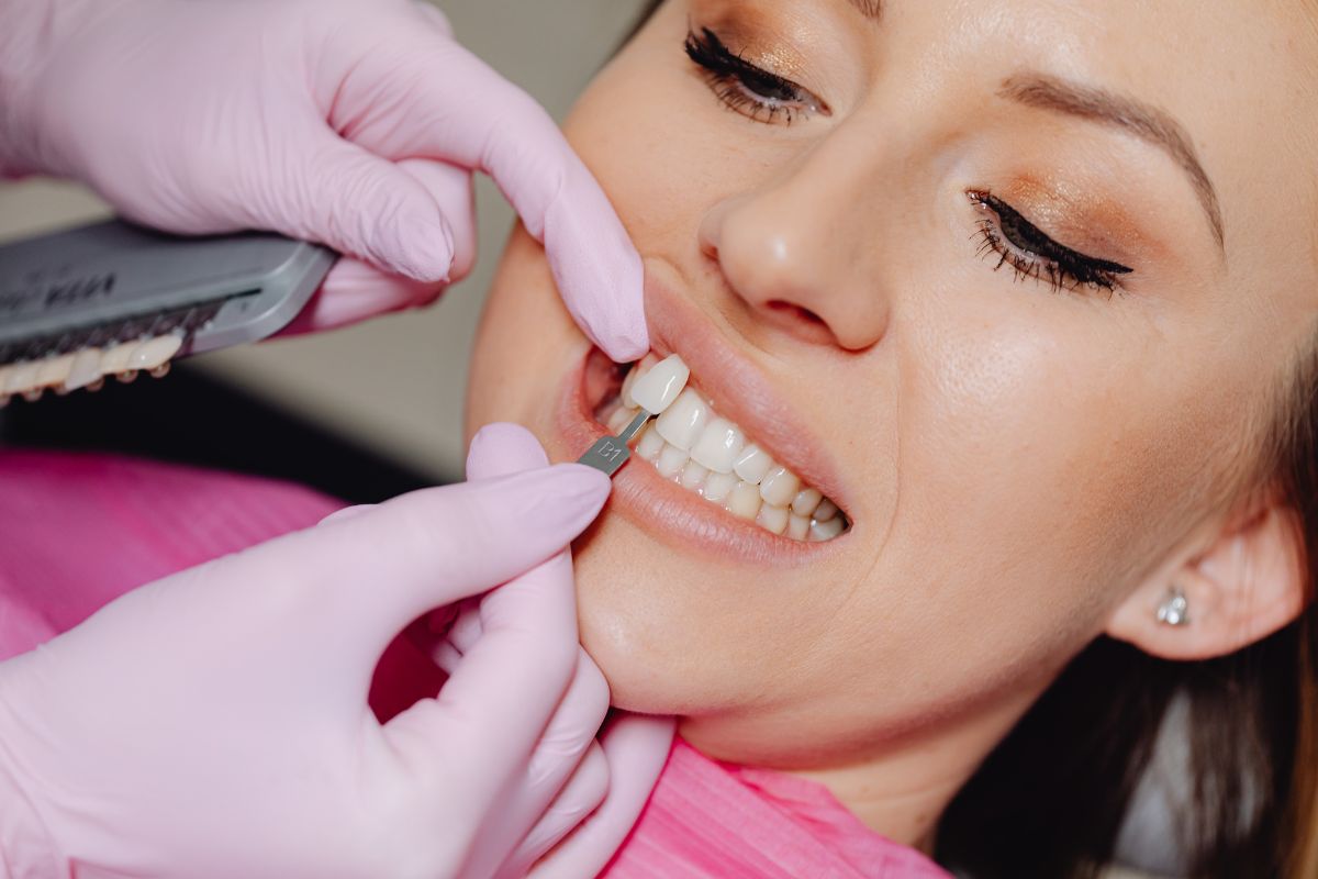 Veneers in Knoxville TN - Cosmetic Dentist - Knoxville Smiles at Malone