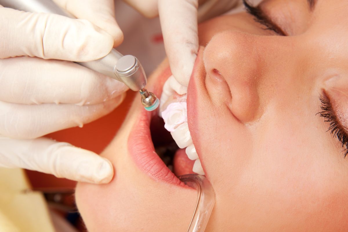 Reversible Cosmetic Bonding in Knoxville TN at Knoxville Smiles at Malone