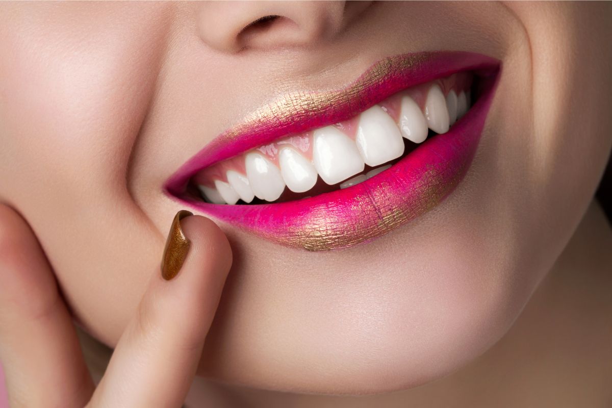 The Real Work Starts After Whitening: Here’s Why