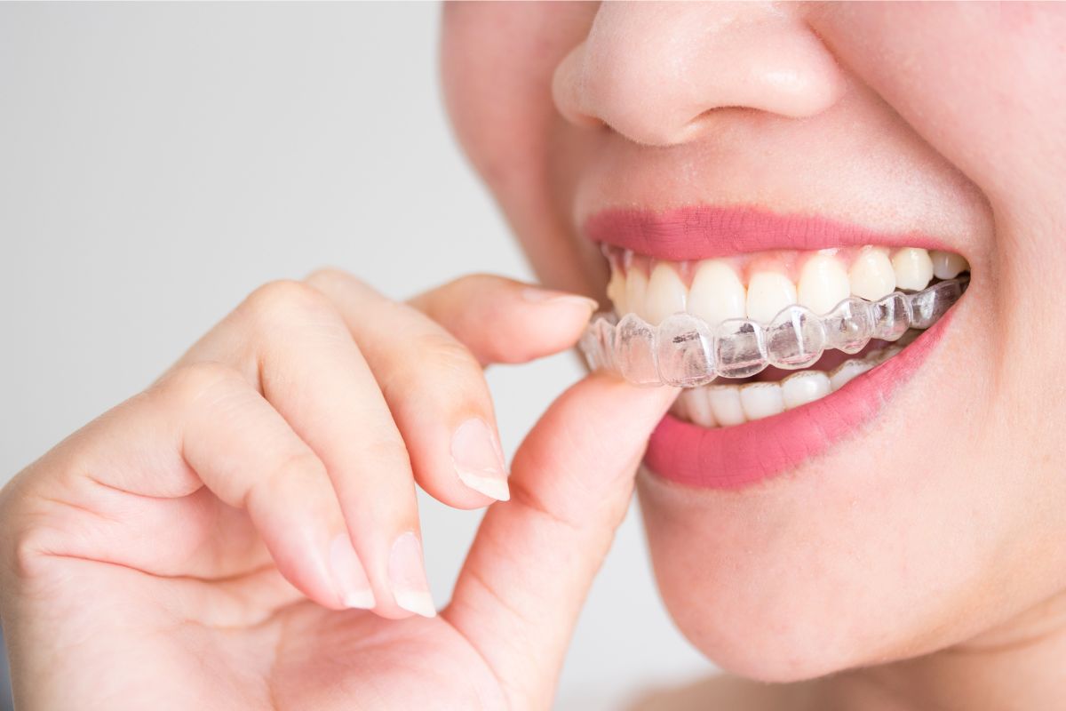 Does Dr. Michael Costa Accept Insurance for Invisalign?