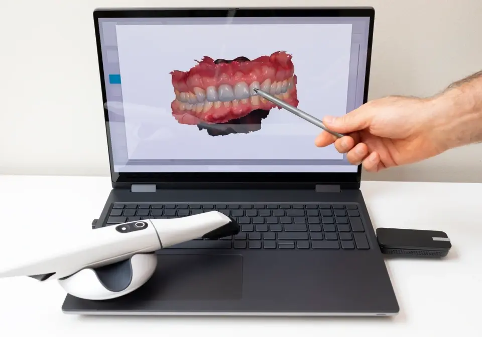 img advanced technology intraoral camera